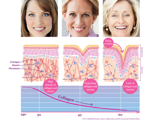 Lượng collagen và elastin trong cơ thể bắt đầu suy giảm theo độ tuổi, làm xuất hiện các dấu hiệu lão hóa da.